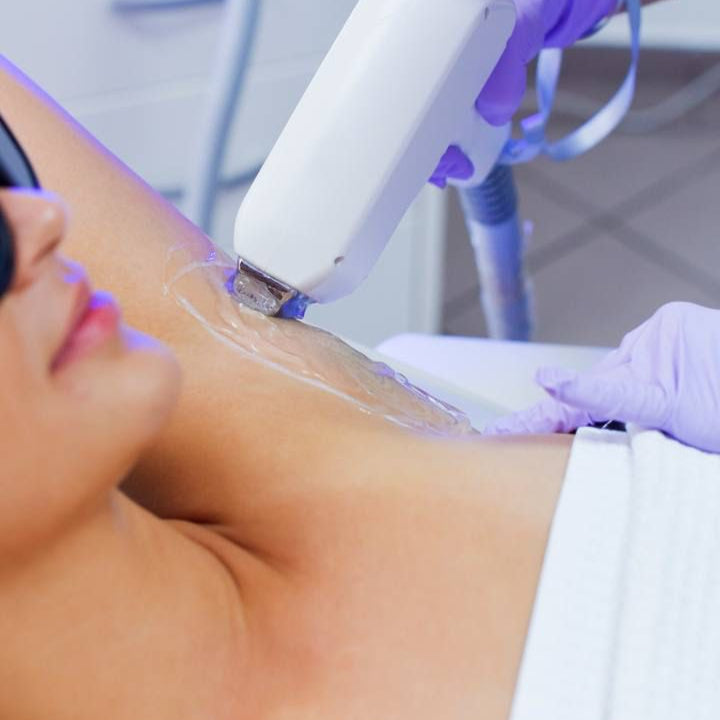 Laser Hair Removal : Upper Body