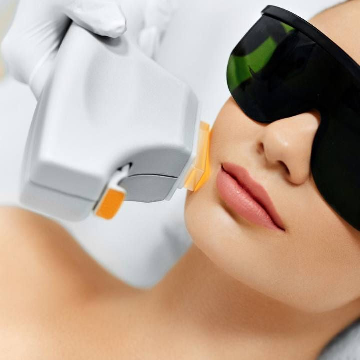 Laser Hair Removal : Facial
