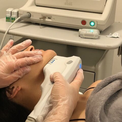 Laser Hair Removal : Facial
