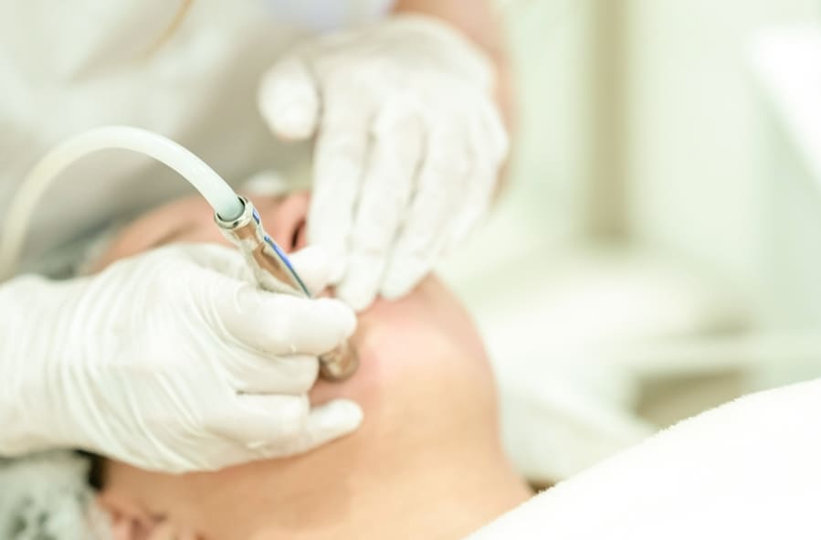 Micro-Dermabrasion