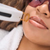Laser Hair Removal : Facial